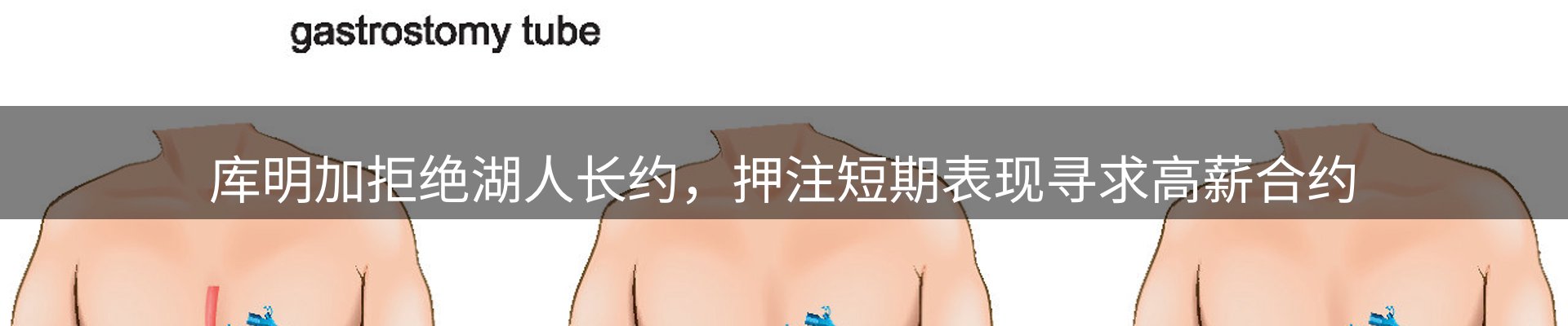 热点汇集